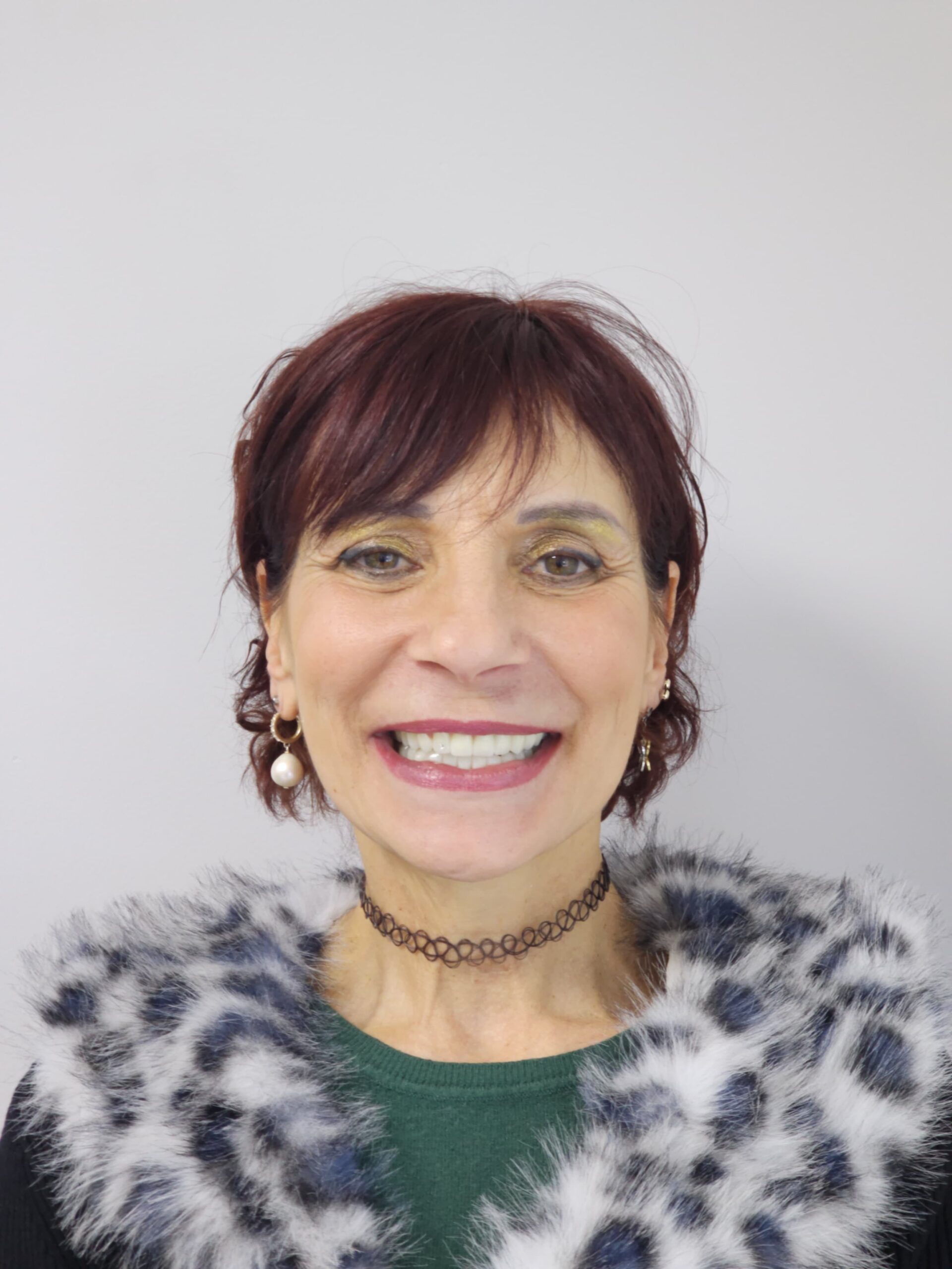 Jaw Implant Placement and Full Mouth Dental Implants in Tirana: Cristina’s Smile Restoration