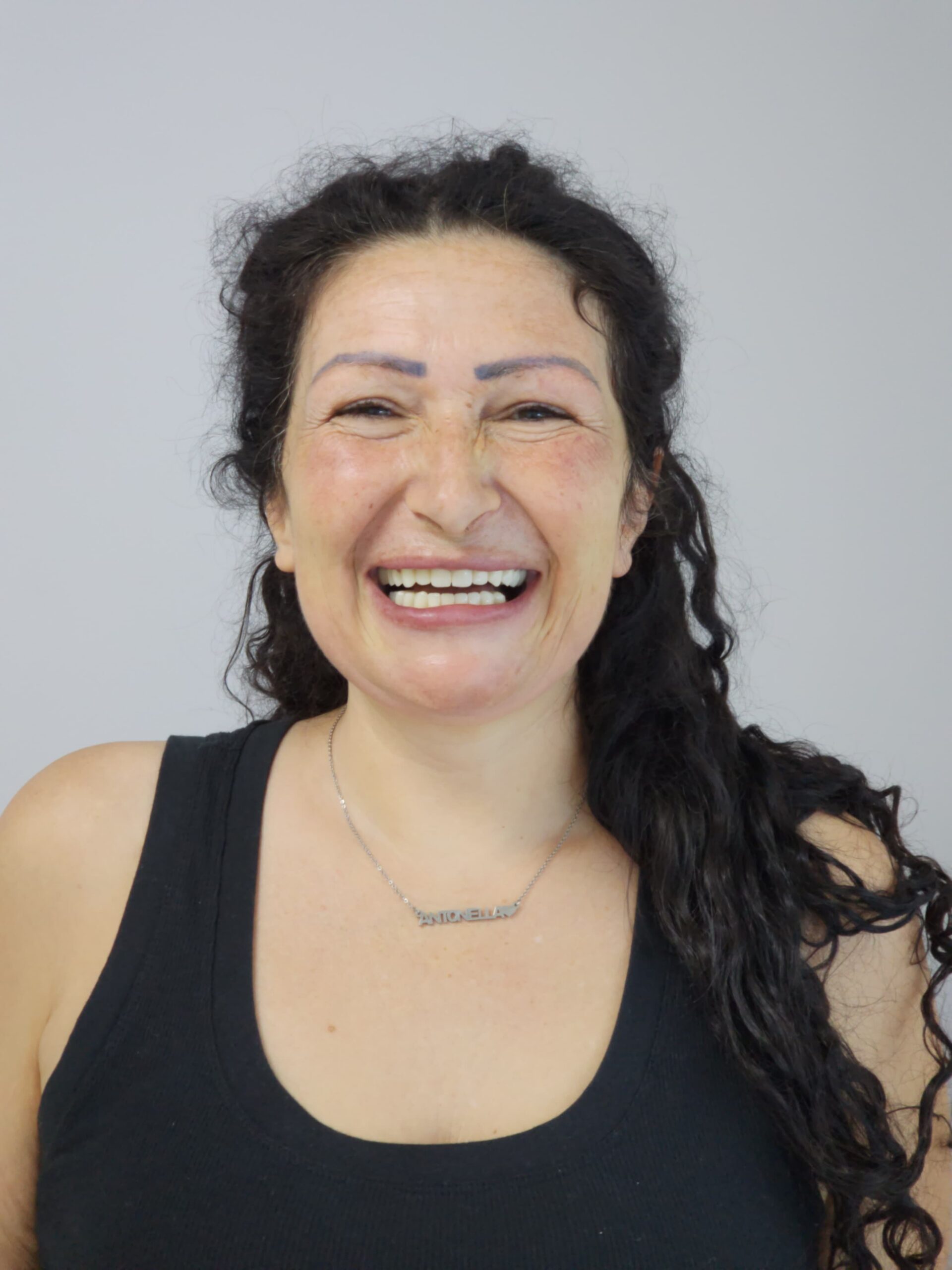 Laser Therapy for Periodontal Disease and Zirconia Crowns in Tirana: Restorative Dental Solutions