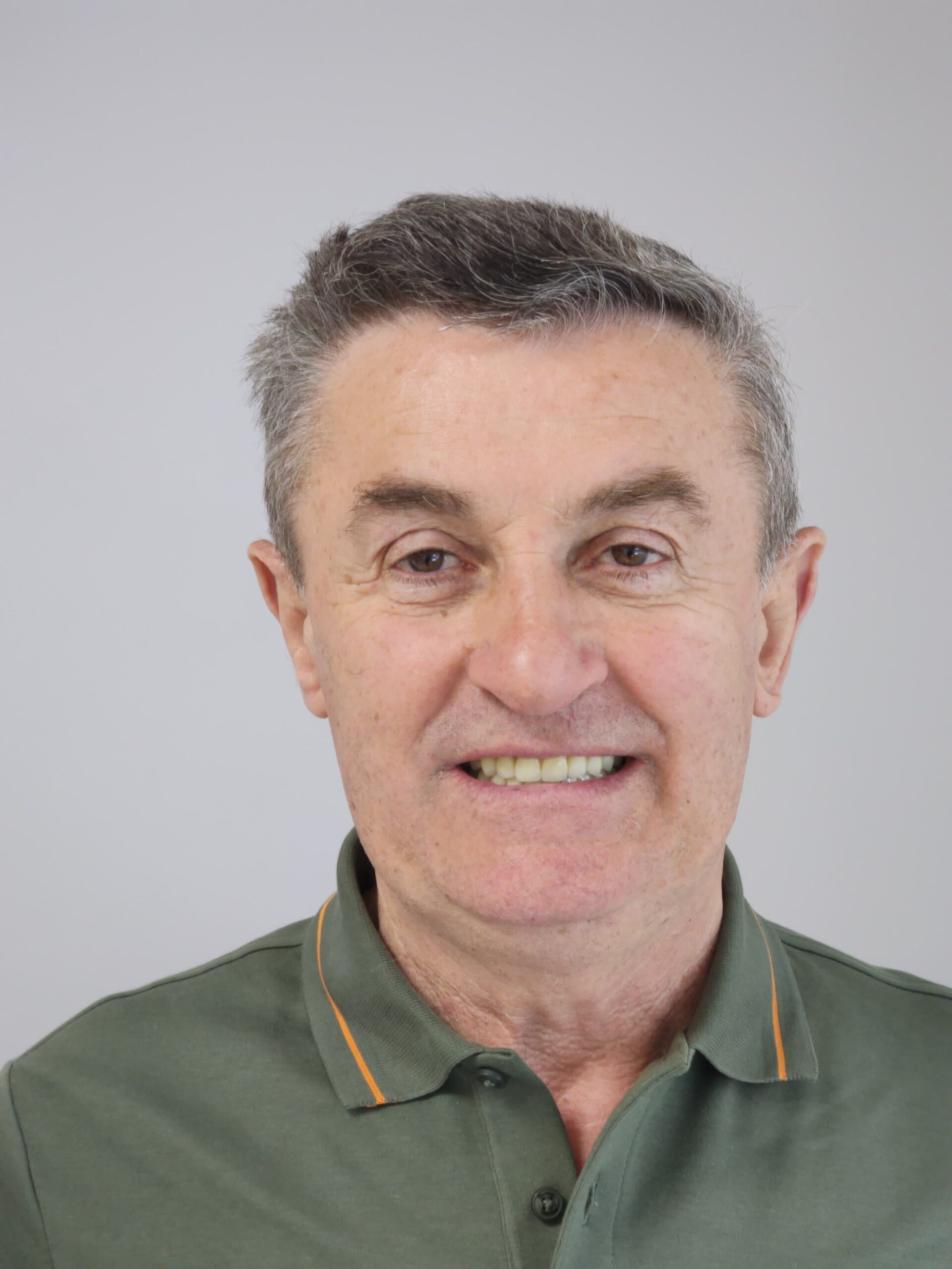 Comprehensive Smile Rehabilitation with Zirconia Crowns and Dental Implants in Tirana