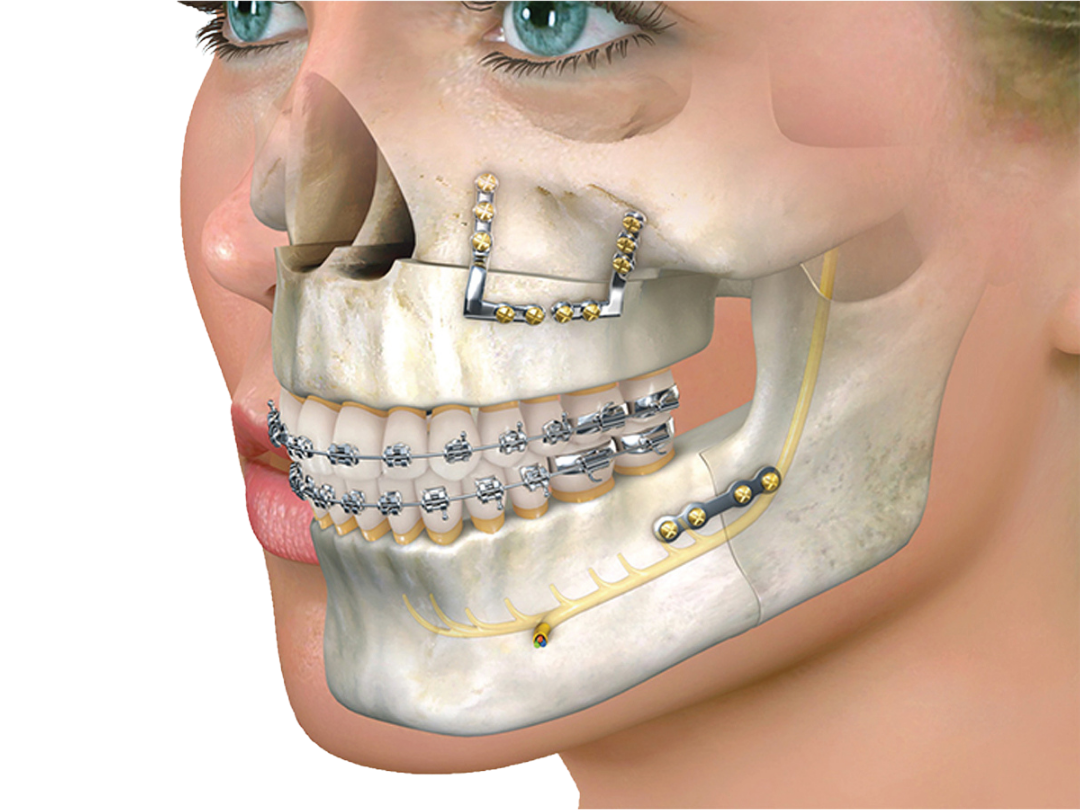 Maxillofacial surgery Maxillofacial surgery at tirana dental center