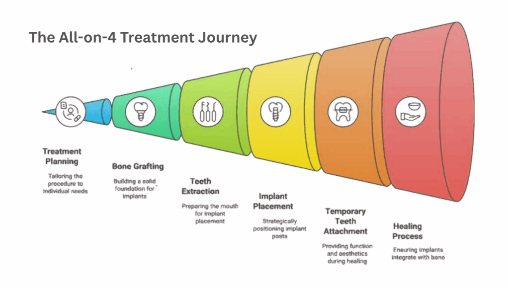 The All-on-4 Treatment Journey at Tirana Dental Center