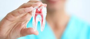 Microsurgical apical root end resection performed by dental specialist