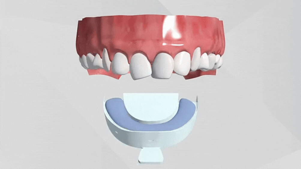 Invisalign 3D animation Gif at tirana dental center