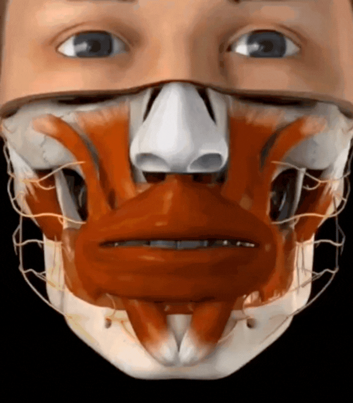 Laser Gingivectomy 3D animation